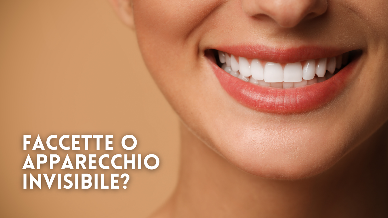 Faccette o apparecchio invisibile? Pro e contro a confronto