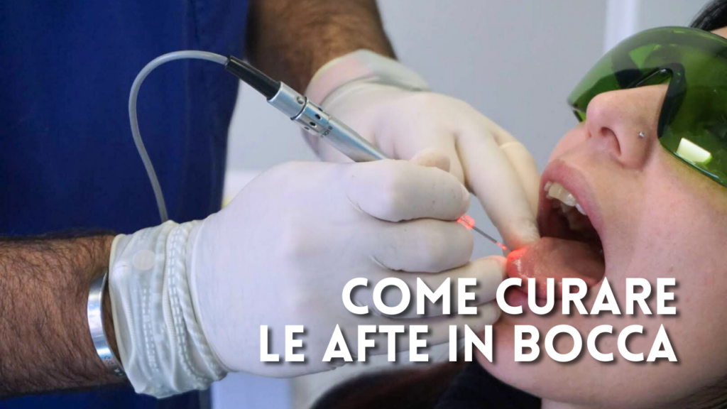 Come curare le afte alla bocca
