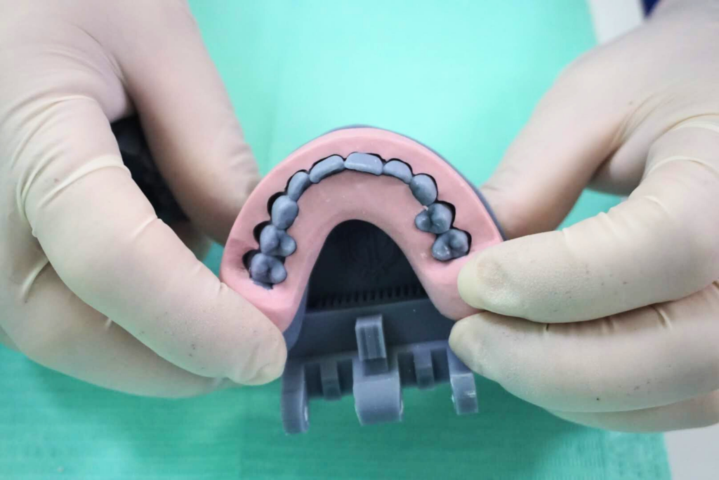 Faccette Dentali