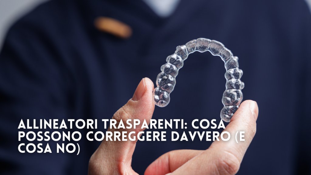 Allineatori Trasparenti