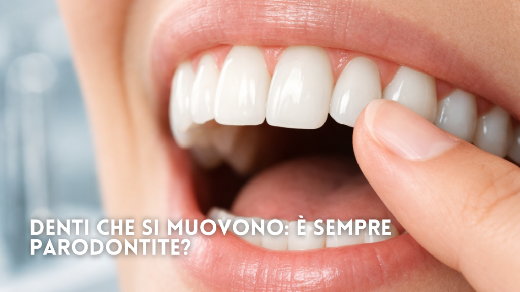Denti che si Muovono