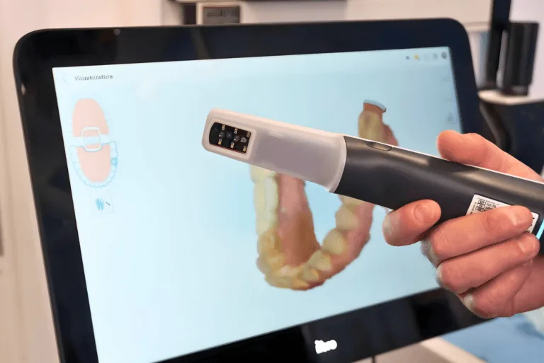 Implantologia Senza Bisturi, denti in 5 ore
