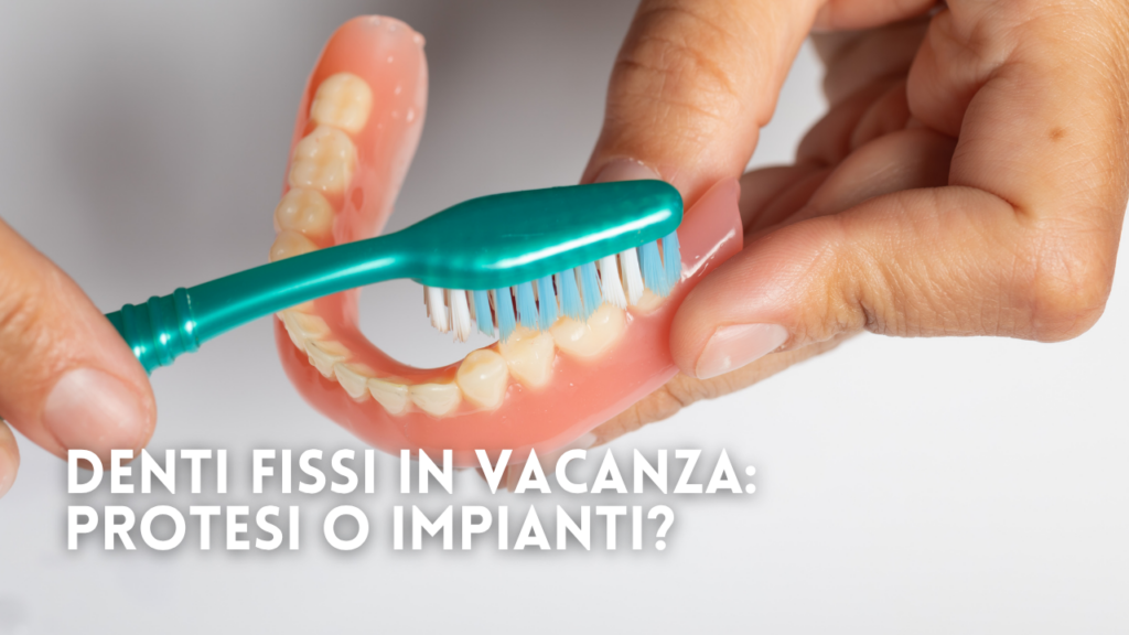 Denti Fissi in Vacanza