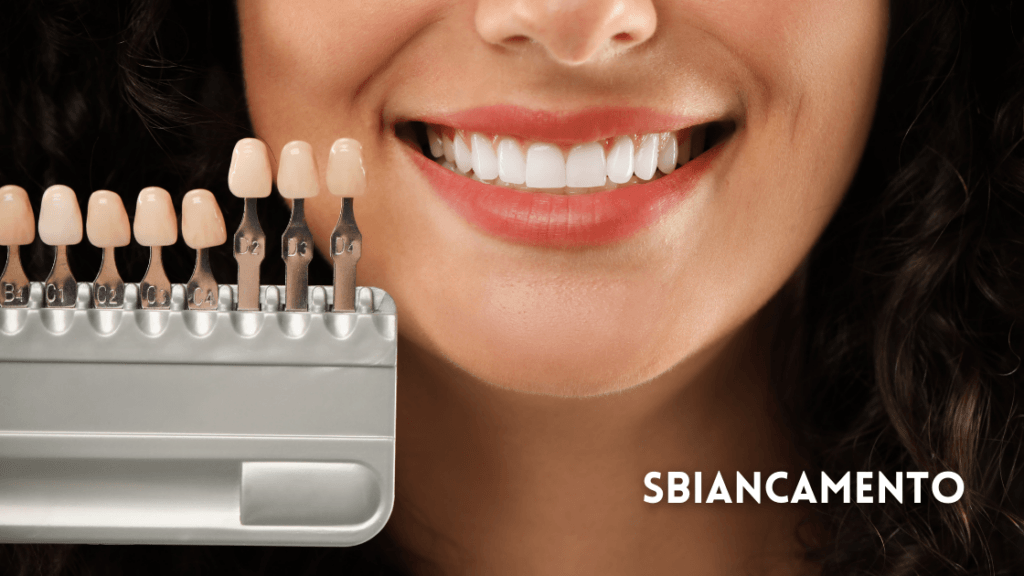 Sbiancamento Dentale