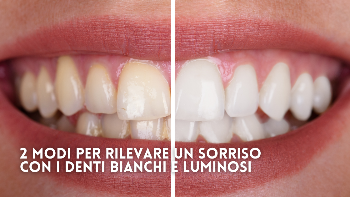 Due modi per ritrovare un sorriso con denti bianchi e luminosi