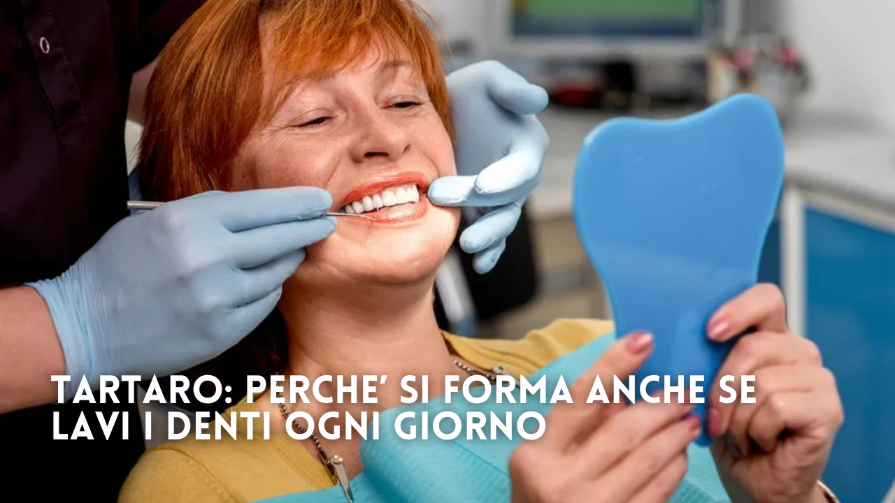 Tartaro: perché si forma anche se ti lavi i denti ogni giorno?