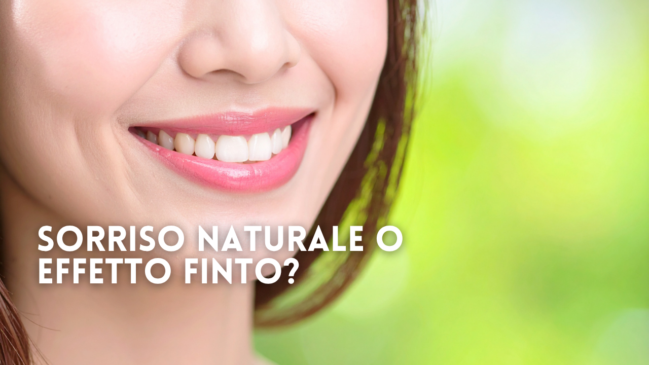 Sorriso naturale o effetto “finto”? Come evitare l’eccesso