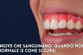 Gengive che sanguinano: quando non è normale (e come si cura)